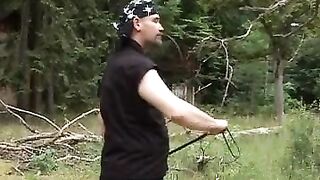 2012-05-21--welts-and-bruises