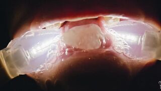 2024-05-17-739-subcumhole_720p