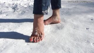 2011-07-02-37-tough-feet-in-snow-part-1