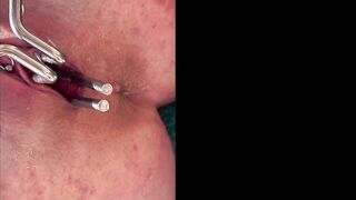 guy-pe-e-inside-her-pussy-with-speculum-on-the-beach_orig